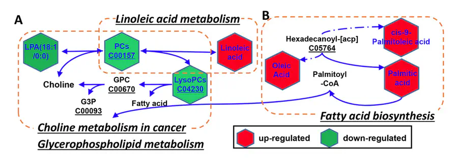 Serum metabolomics for early diagnosis of esophageal squamous cell carcinoma by UHPLC-QTOF/MS